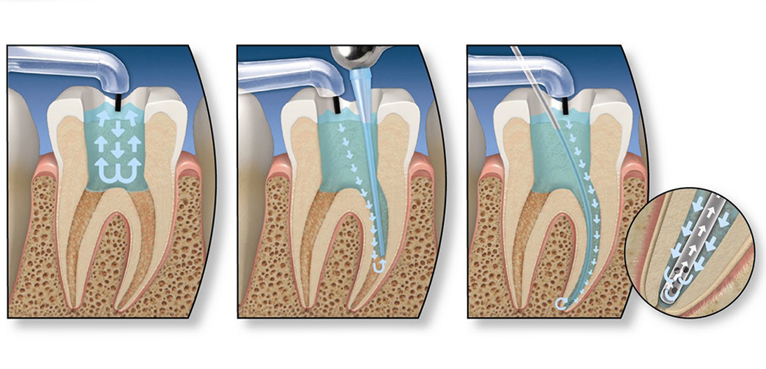 Endodontia