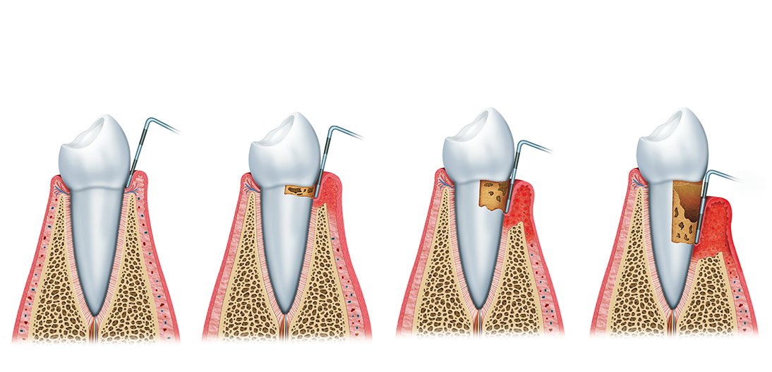 Periodontia
