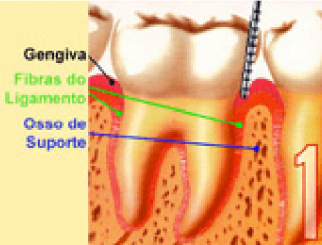 periodontia_estagio-1-322x245
